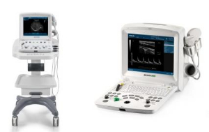 全數(shù)字超聲診斷系統(tǒng) dus 60