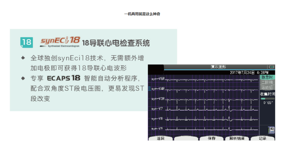 原裝進(jìn)口ECG-2360十二道心電圖機(jī)3.png