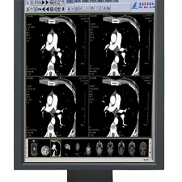 醫(yī)學影像處理系統(tǒng)RCZ-200D