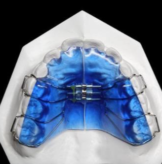華偉定制式矯治器擴弓型、矯治保持型、牙膠片型