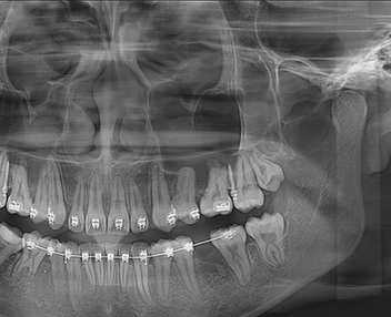 美亞光電mydentviewer口腔醫(yī)學影像處理軟件