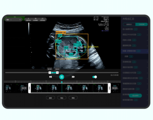 產(chǎn)前動(dòng)態(tài)超聲影像處理系統(tǒng)airiscan q6